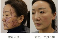 -丰联丽格医疗美容·联合丽格眼整形中心