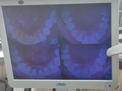 -爱牙联合口腔(门诊报销 海云庵店)