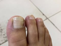 -新甲连锁灰指甲·甲沟炎·鸡眼(黑龙江路店)