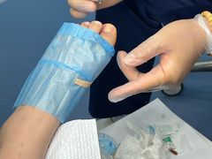 -Andrew指甲专科灰指甲·甲沟炎矫正·3D步态矫形鞋垫定制(浦三路店)