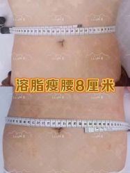 -Lily纤美·科技减脂中心