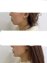 点击看大图 -Yestar重庆艺星医疗美容医院