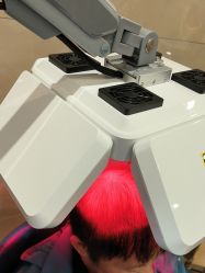 -碧莲盛·不剃发植发