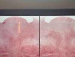 -苑苑vbeauty科技美容SPA
