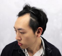 -大麦微针植发丨全国连锁