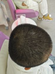 -北京雍禾植发医院