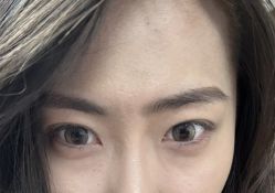 -天津健丽·去眼袋医疗美容机构