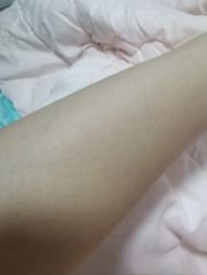 -嘉和医学脱毛中心