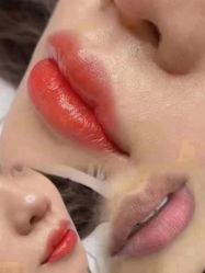 -郡艺医疗美容·微整·眼鼻吸脂