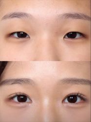 -联合丽格·张菡丽格医疗美容