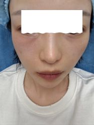 体验后-上海伊莱美医疗美容医院