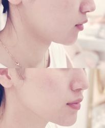 -LUNA皮相美·骨相美高级美感