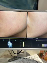 -苑苑vbeauty科技美容SPA