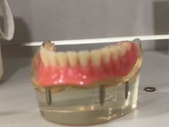 -上海仁爱医院口腔科 · 种植