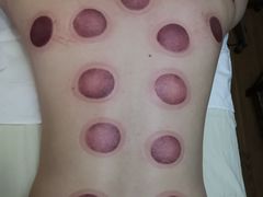-御筋堂正骨推拿(星源国际店)