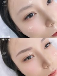 -西施无菌半永久纹绣眉眼影唇轻增发纹发际线