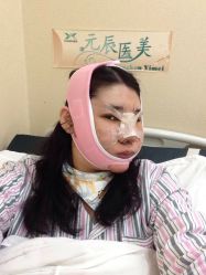 点击看大图 体验后-鑫元辰医疗美容整形
