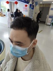 -大麦微针植发全国连锁