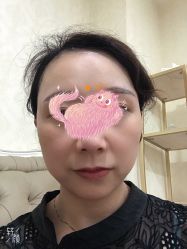 体验后-重庆军科整形美容医院