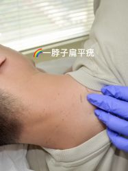 -清疣美疣·痣·斑净肤中心