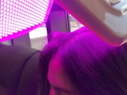 -碧莲盛·不剃发植发