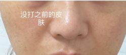-纯粹医美