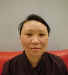 P1090045-芷妍医美