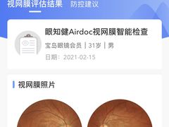 -宝岛眼镜(北京亚运村旗舰店)
