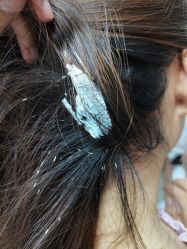 -痘博士北京·全国连锁祛痘机构