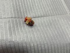 -爱齿尔口腔美学种植中心(永清院)