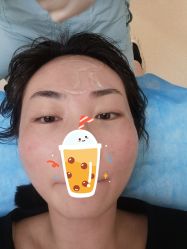 体验前-联合丽格·张菡丽格医疗美容