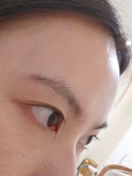 -长沙雅美医疗美容医院