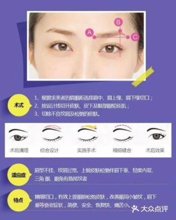 一个手术三个效果，可以改善你的#三角眼