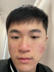 体验后-郑荃丽格医疗美容