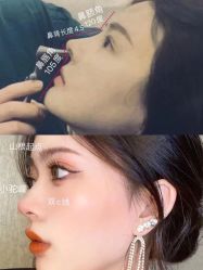 -成都西区医院整形美容