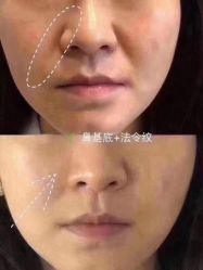 -上海漾颜医疗美容