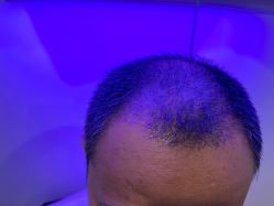 -熙朵美学植发·连锁品牌