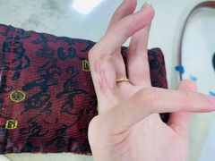 -杭州仁易堂中医康复医院疤痕修复