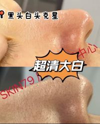 -SKIN79皮肤管理中心