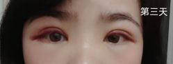 -广州美莱医疗美容医院
