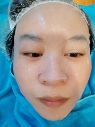 体验后-一美医疗美容
