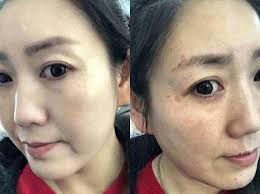 -SKINIST丽铂医疗美容