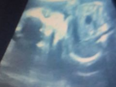 宝宝的超声波照-上海市第七人民医院