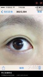 韩式美瞳线-平萍纹绣韩式半永久定妆