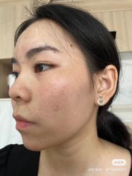 -skin79皮肤管理基站