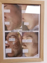 -美肤盾祛痘·问题肌头疗管理中心