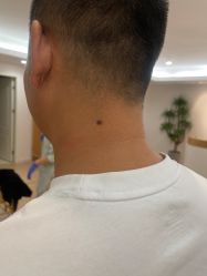 -清疣美疣·痣·斑净肤中心