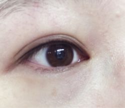 刚做完韩式半永久隐形线-平萍纹绣韩式半永久定妆