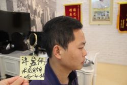 点击看大图 -大麦微针植发丨全国连锁