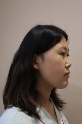 -北京米扬丽格医疗美容·联合丽格鼻整形中心